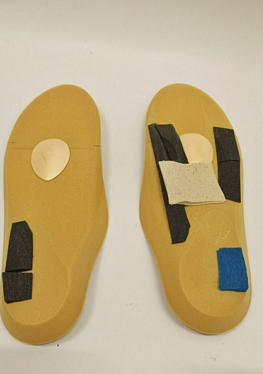 коррекция индивидуальных стелек